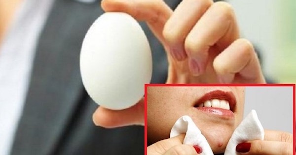Yumurta ile Siyah Noktalardan Kurtulmak